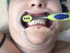 Dentist Probes Naughty Girl's Mouth